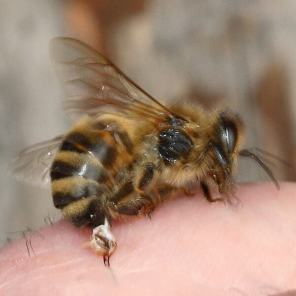 Bee Sting